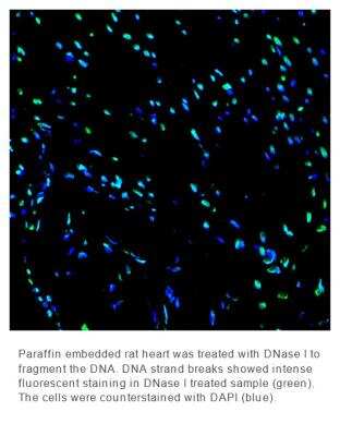 Fluorescence Imaging: OneStep TUNEL Apoptosis Kit [FITC] [NBP3-11957]